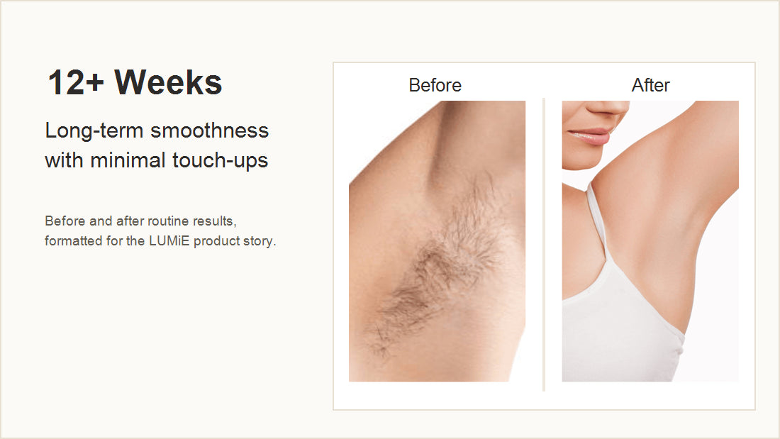 LUMiE 12 week before and after smoothness result